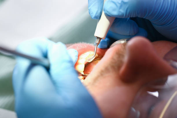 Best Emergency Tooth Extraction in Leadington, MO