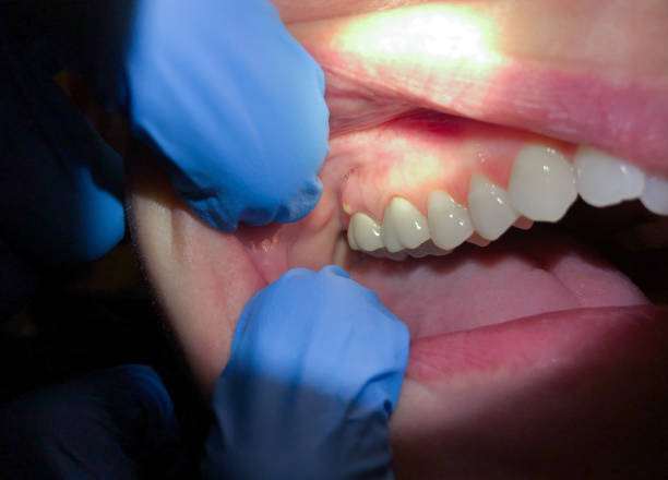 Best Emergency Broken Tooth Repair in Leadington, MO