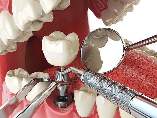 Best Emergency Dental Care for Trauma or Injury in Leadington, MO